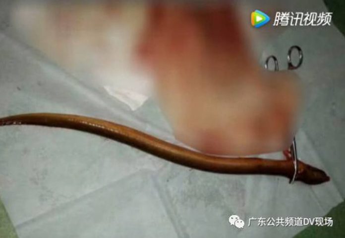 eel
