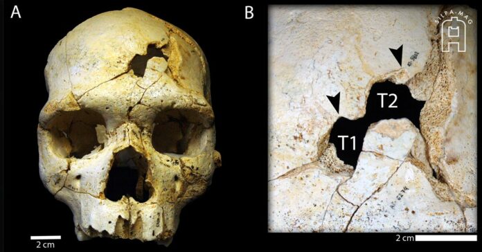ภาพปก - ฆาตกรรม กะโลหกศีรษะ มนุษย์โบราณ ผู้ถูก ฆาตกรรม พบในถ้ำ สเปน