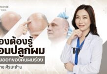 ปลูกผม วิธีจัดการปัญหาศีรษะล้านถาวร เสริมความมั่นใจให้เต็มเปี่ยม ปลูกผม