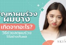 ปัญหาผมร่วง ผมบาง เกิดจากอะไร วิธีไหนที่ช่วยลดผมร่วงได้อย่างเห็นผล ผมร่วง