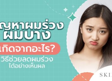 ผมร่วง