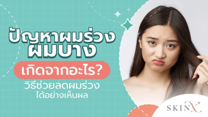 03 ผมร่วง