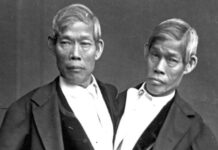 แฝดสยาม อิน-จัน อินจัน