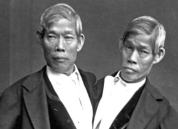 แฝดสยาม อิน-จัน อินจัน